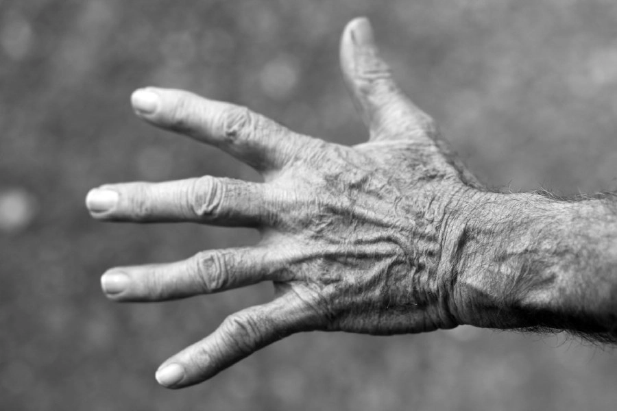 Conheça os 6 melhores tratamentos para o rejuvenescimento das mãos